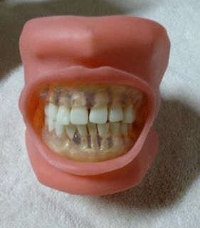 Kilgore Dental Typodont Model Clear Periodontal Training NR